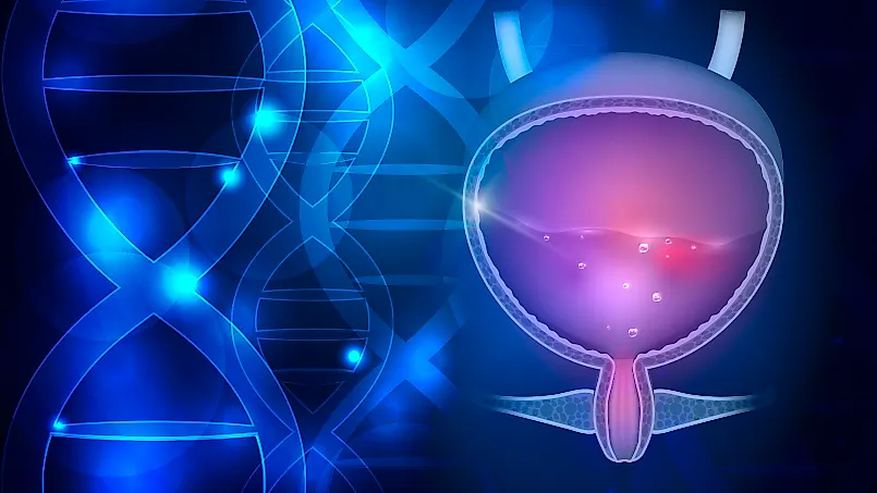 Экстрофия мочевого пузыря