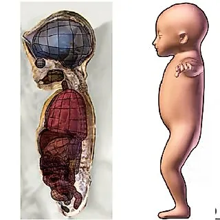 Генетические расстройства