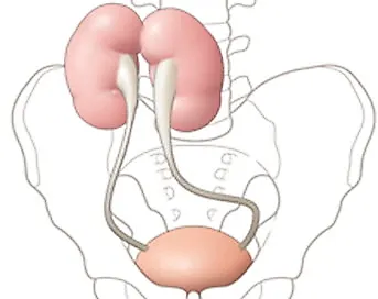 Повреждения мочеточника