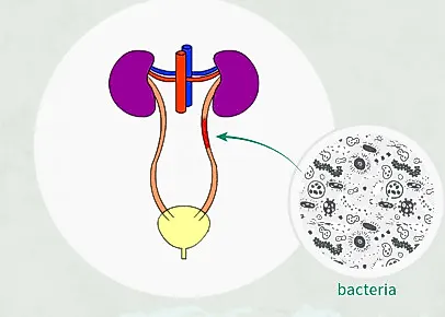 Инфекционные воспалительные заболевания