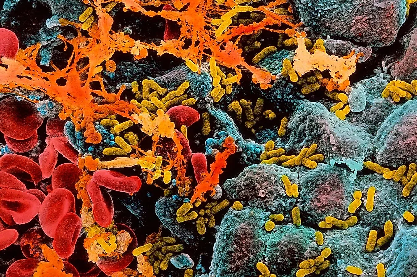 Цистит и кариес могут ускорить развитие деменции