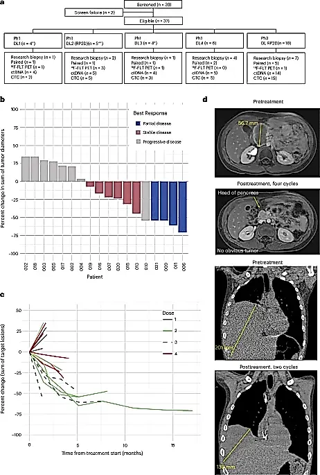 Новый подход к лечению саркомы Юинга: как два лекарства помогают там, где другие бессильны