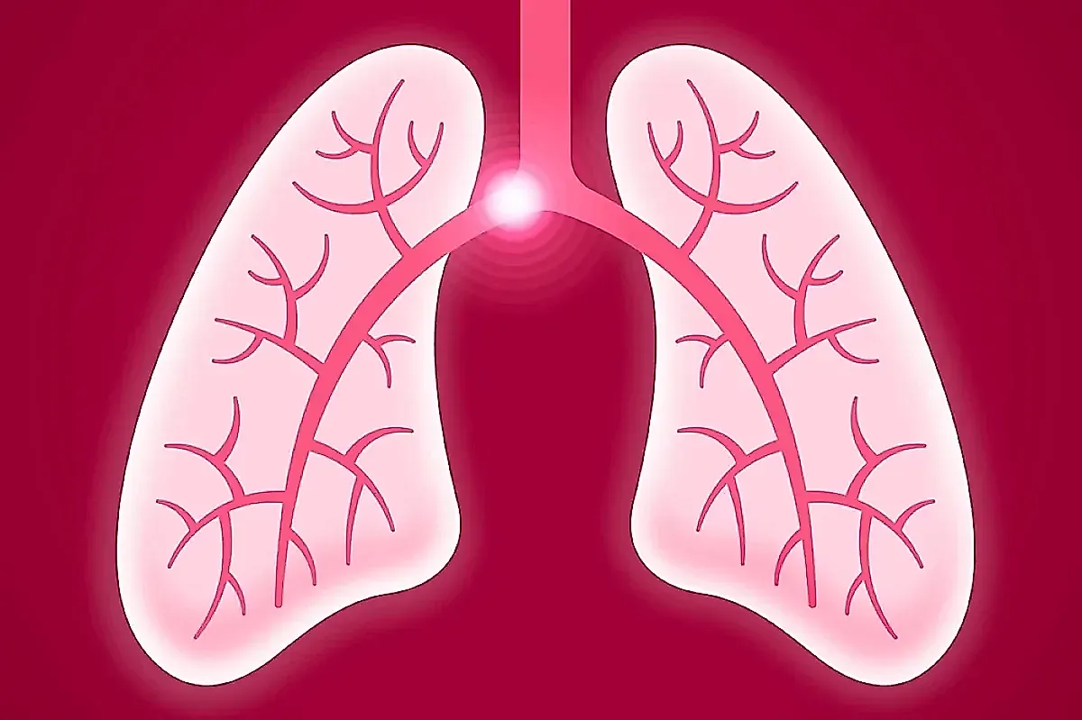Тромбоэмболия легочной артерии: симптомы, риски и профилактика по мнению доктора Мясникова