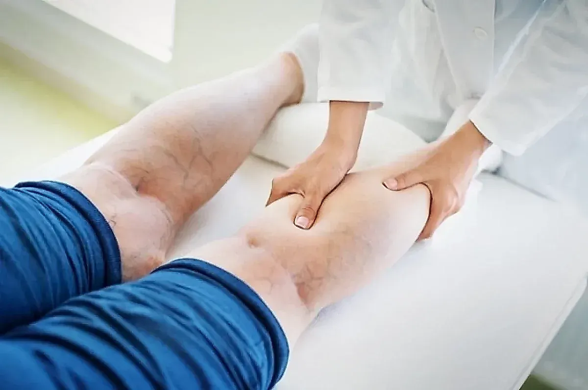 Флеболог Елена Смирнова: как сидячая работа влияет на варикоз и что делать для профилактики