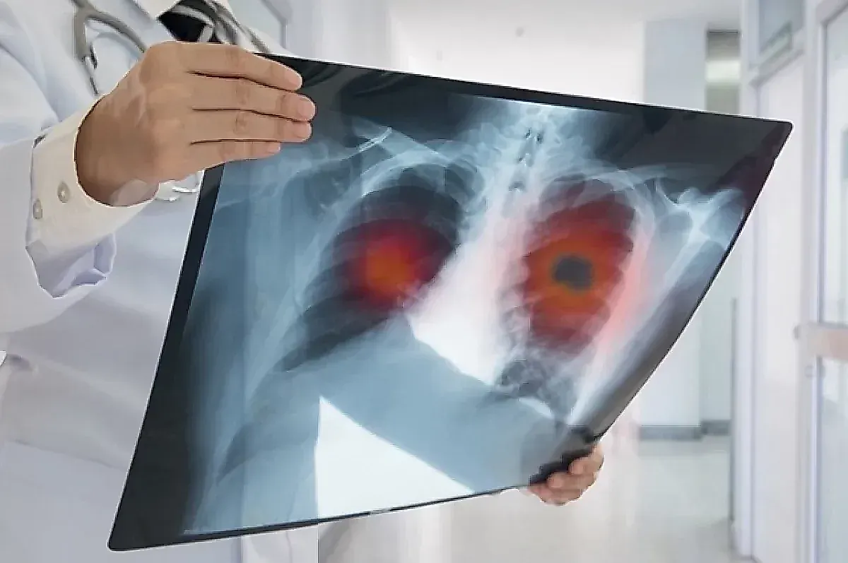 История Стаматиса Мораитиса: как мужчина прожил 40 лет с терминальным раком легких после переезда на остров Икария