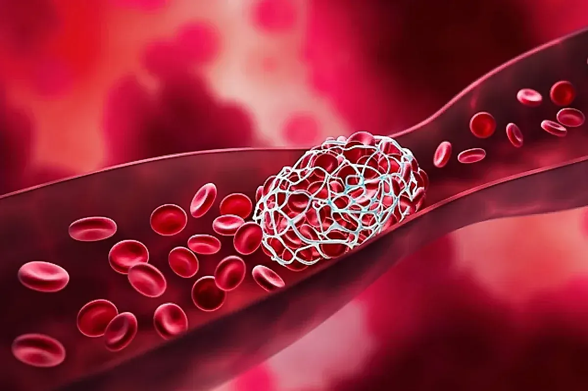 Инсульт у молодых: почему погибла стримерша Ван Ефэй и как защитить себя от кровоизлияния в мозг
