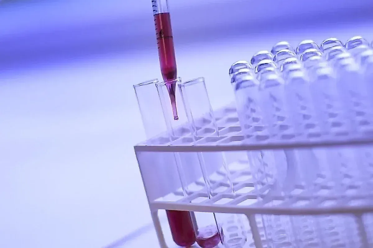 МРТ всего тела, тестостерон, АМГ: какие медицинские тесты могут быть бесполезны и опасны по мнению эксперта