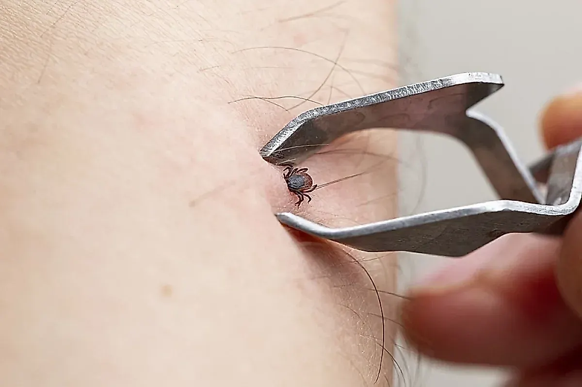 Укус клеща: что делать в первые 3 дня, советы врача Романа Фишкина