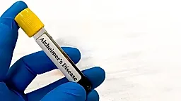 Проблемы с почками могут искажать тесты на болезнь Альцгеймера