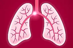 Тромбоэмболия легочной артерии: симптомы, риски и профилактика по мнению доктора Мясникова