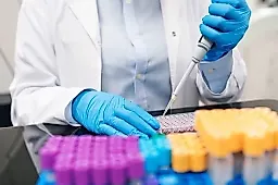 Повышенная амилаза в крови: не только панкреатит. Объясняет гастроэнтеролог Ольга Сухарева