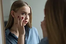 Розацеа: симптомы, причины и современное лечение хронического покраснения кожи лица