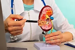 COVID-19 и почки: как коронавирус повышает риск тяжёлых поражений в 4,7 раза