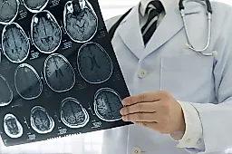 Инфекции у детей и риск инсульта: новое исследование австралийских учёных