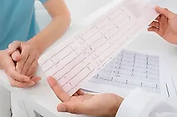 Аритмия после лечения: 4 скрытых причины рецидива и как их избежать