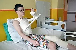 Укус клеща и вялый паралич: история Дениса, симптомы, лечение и профилактика клещевого энцефалита