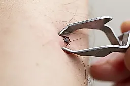 Укус клеща: что делать в первые 3 дня, советы врача Романа Фишкина