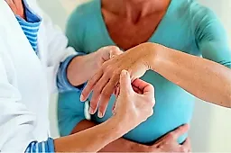 Артрит кисти: простой тест за минуту и что делать дальше