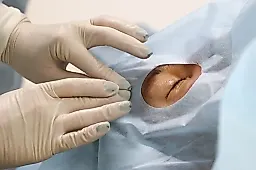 Ухудшение зрения у взрослых: почему это не всегда близорукость и что скрывает миопизация хрусталика