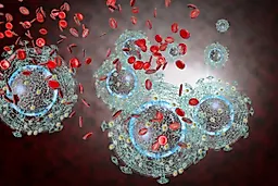 ВИЧ-инфекция (СПИД)