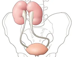 Повреждения мочеточника