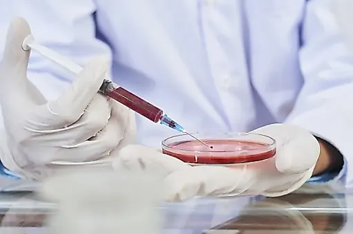 Марбургская лихорадка: вирусолог о симптомах, передаче и опасности из пещеры Уганды