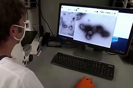 Оспа обезьян в России: оценка рисков от эпидемиолога Геннадия Онищенко