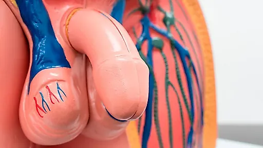 Варикоцеле