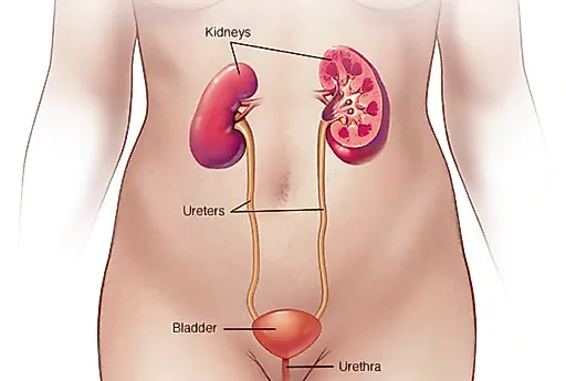 Заболевания мочевых путей у женщин